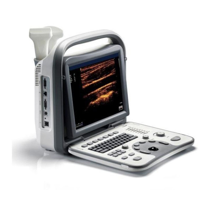 (B/W ultrasound machine)