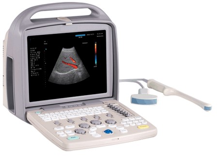 (جهاز الالتراساوند المحمول Color doppler)